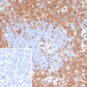 Formalin-fixed, paraffin-embedded human tonsil stained with CD7 Recombinant Rabbit Monoclonal Antibody (CD7/8118R). Inset: PBS instead of primary antibody; secondary only negative control.