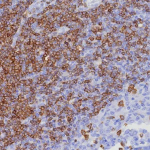 Formalin-fixed, paraffin-embedded human lymph node stained with CD7 Recombinant Rabbit Monoclonal Antibody (CD7/8357R). h HIER: Tris/EDTA, pH9.0, 45min. 2: HRP-polymer, 30min. DAB, 5min.