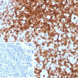 Formalin-fixed, paraffin-embedded human tonsil stained with CD7 Recombinant Rabbit Monoclonal Antibody (CD7/8496R). Inset: PBS instead of primary antibody; secondary only negative control.