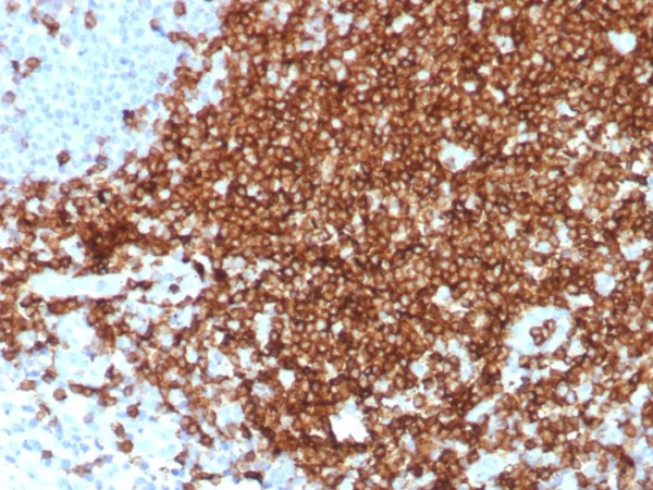 Formalin-fixed, paraffin-embedded human tonsil stained with CD7 Recombinant Rabbit Monoclonal Antibody (CD7/8496R). HIER: Tris/EDTA, pH9.0, 45min. 2°C: HRP-polymer, 30min. DAB, 5min.