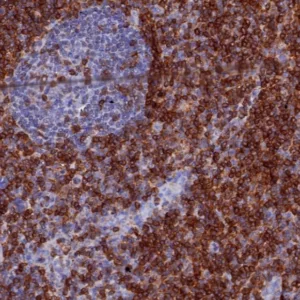 Formalin-fixed, paraffin-embedded human tonsil stained with CD7 Recombinant Rabbit Monoclonal Antibody (CD7/3868R). HIER: Tris/EDTA, pH9.0, 45min. 2°C: HRP-polymer, 30min. DAB, 5min.