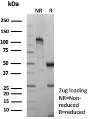 SDS-PAGE Analysis  Purified CD8 Recombinant Mouse Monoclonal Antibody (rCD8/9211). Confirmation of Integrity and Purity of Antibody.