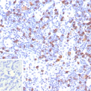 Formalin-fixed, paraffin-embedded human lymph node stained with CD8a Recombinant Rabbit Monoclonal Antibody (CD8/7793R). Inset: PBS instead of primary antibody; secondary only negative control.