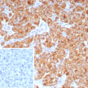 Formalin-fixed, paraffin-embedded human pancreas stained with  CD9 Mouse Monoclonal Antibody (CD9/7416). Inset: PBS instead of primary antibody; secondary only negative control.