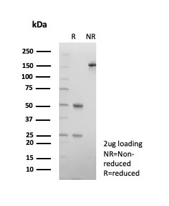 SDS-PAGE Analysis of Purified CD9 Mouse Monoclonal Antibody (CD9/7417). Confirmation of Purity and Integrity of Antibody.