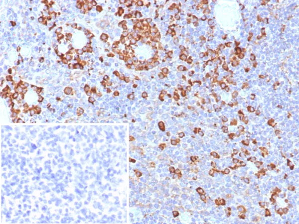 Formalin-fixed, paraffin-embedded human tonsil stained with  CD9 Mouse Monoclonal Antibody (CD9/7417). Inset: PBS instead of primary antibody; secondary only negative control.