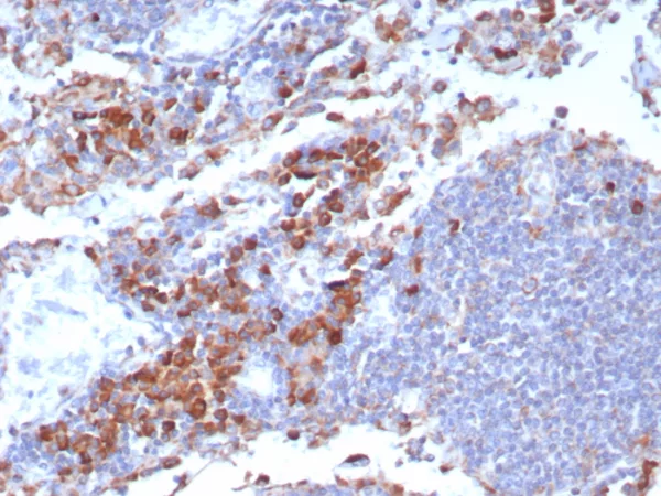 Formalin-fixed, paraffin-embedded human lymph node stained with  CD9 Mouse Monoclonal Antibody (CD9/7417). HIER: Tris/EDTA, pH9.0, 45min. 2°C: HRP-polymer, 30min. DAB, 5min.