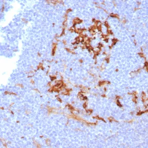 Formalin-fixed, paraffin-embedded human lymph node stained with CD14 Mouse Monoclonal Antibody (LPSR/7738). HIER: Tris/EDTA, pH9.0, 45min. 2°C: HRP-polymer, 30min. DAB, 5min.