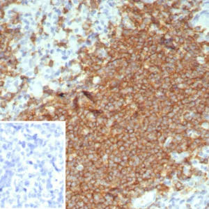 Formalin-fixed, paraffin-embedded human tonsil stained with CD20 Rabbit Recombinant Monoclonal Antibody (rMS4A1/8044). Inset: PBS instead of primary antibody; secondary only negative control.