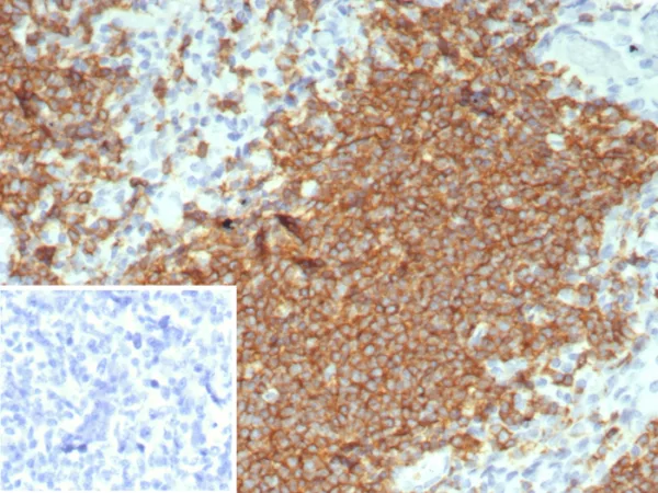 Formalin-fixed, paraffin-embedded human tonsil stained with CD20 Rabbit Recombinant Monoclonal Antibody (rMS4A1/8044). Inset: PBS instead of primary antibody; secondary only negative control.