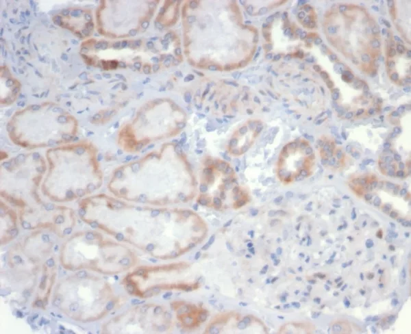 Formalin-fixed, paraffin-embedded human kidney stained with CD20 Recombinant Rabbit Monoclonal Antibody (MS4A1/6993R). HIER: Tris/EDTA, pH9.0, 45min. 2°C: HRP-polymer, 30min. DAB, 5min.