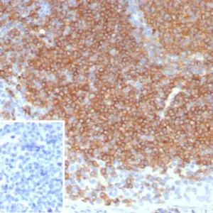 Formalin-fixed, paraffin-embedded human tonsil stained with CD22 Recombinant Rabbit Monoclonal Antibody (BLCAM/8113R). Inset: PBS instead of primary antibody, secondary control.