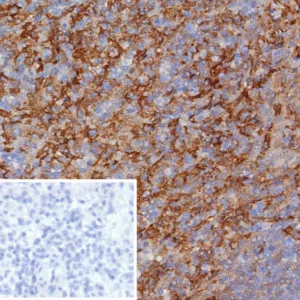 Formalin-fixed, paraffin-embedded human spleen stained with CD163 Recombinant Rabbit Monoclonal Antibody (M130/8361R). HIER: Tris/EDTA, pH9.0, 45min. 2: HRP-polymer, 30min. DAB, 5min.