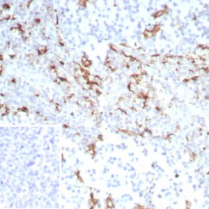 Formalin-fixed, paraffin-embedded human tonsil stained with CD163 Recombinant Rabbit Monoclonal Antibody (M130/8821R). Inset: PBS instead of primary antibody; secondary only negative control.