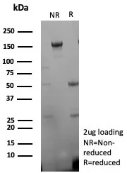 SDS-PAGE Analysis of Purified CD27 Recombinant Mouse Monoclonal Antibody (rLPFS2/8836). Confirmation of Purity and Integrity of Antibody.