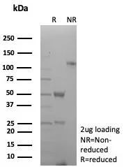 SDS-PAGE Analysis of Purified CD27 Recombinant Mouse Monoclonal Antibody (rLPFS2/8837). Confirmation of Purity and Integrity of Antibody.