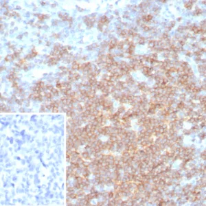Formalin-fixed, paraffin-embedded human lymph node stained with CD27 Rabbit Recombinant Monoclonal Antibody (LPFS2/8316R). Inset: PBS instead of primary antibody; secondary only negative control.