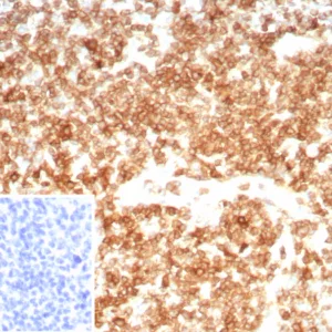 Formalin-fixed, paraffin-embedded human tonsil stained with CD27 Rabbit Recombinant Monoclonal Antibody (LPFS2/8607R). Inset: PBS instead of primary antibody; secondary only negative control.