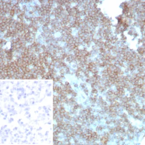 Formalin-fixed, paraffin-embedded human lymph node stained with CD27 Rabbit Recombinant Monoclonal Antibody (LPFS2/8838R). Inset: PBS instead of primary antibody; secondary only negative control.