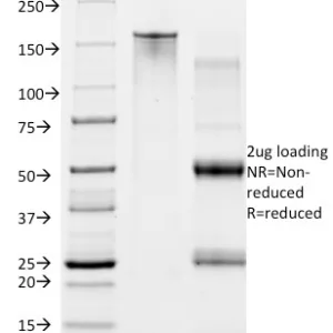 SDS-PAGE Analysis of Purified CD28 Mouse Monoclonal Antibody (CB28). Confirmation of Integrity and Purity of Antibody.