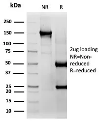 SDS-PAGE Analysis of Purified CD33 Mouse Monoclonal Antibody (SIGLEC3/3597). Confirmation of Integrity and Purity of Antibody.