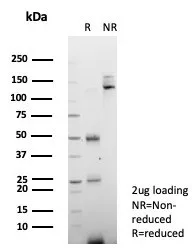 SDS-PAGE Analysis of Purified CD34 Mouse Monoclonal Antibody (CD34/7719). Confirmation of Purity and Integrity of Antibody.