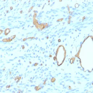 Formalin-fixed, paraffin-embedded human uterus stained with  CD34 Recombinant Mouse Monoclonal Antibody (rHPCA1/8500). HIER: Tris/EDTA, pH9.0, 45min. 2°C: HRP-polymer, 30min. DAB, 5min.