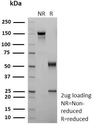 SDS-PAGE Analysis of Purified CD36 Recombinant Mouse Monoclonal Antibody (rGPIIIb/9240). Confirmation of Purity and Integrity of Antibody.