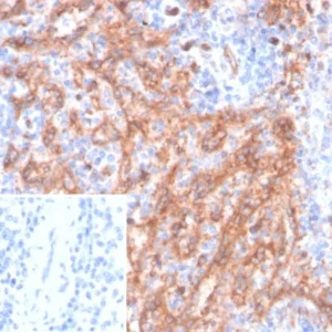 Formalin-fixed, paraffin-embedded human spleen stained with CD36 Mouse Monoclonal Antibody (CD36/7218) at 2ug/ml. Inset: PBS instead of primary antibody; secondary only negative control.
