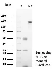 SDS-PAGE Analysis CD38 Recombinant Mouse Monoclonal Antibody (rCD38/6982). Confirmation of Purity and Integrity of Antibody.