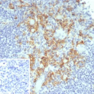 Formalin-fixed, paraffin-embedded human tonsil stained with CD38 Recombinant Mouse Monoclonal Antibody (rCD38/8045). Inset: PBS instead of primary antibody; secondary only negative control.