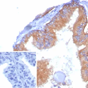 Formalin-fixed, paraffin-embedded human tonsil stained with CD38 Recombinant Mouse Monoclonal Antibody (rCD38/8334). Inset: PBS instead of primary antibody; secondary only negative control.