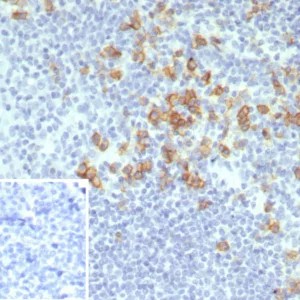 Formalin-fixed, paraffin-embedded human tonsil stained with CD38 Recombinant Rabbit Monoclonal Antibody (CD38/8075R). Inset: PBS instead of primary antibody; secondary only negative control.