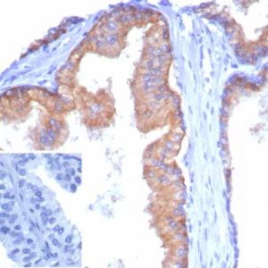 Formalin-fixed, paraffin-embedded human tonsil stained with CD38 Recombinant Rabbit Monoclonal Antibody (CD38/8335R). Inset: PBS instead of primary antibody; secondary only negative control.
