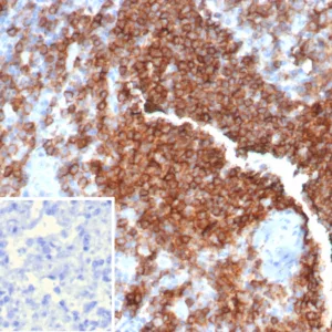 Formalin-fixed, paraffin-embedded human lymph node stained with CD39 Mouse Monoclonal Antibody (CD39/6860). Inset: PBS instead of primary antibody; secondary only negative control.
