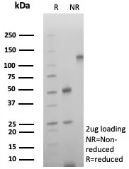 SDS-PAGE Analysis of Purified CD39 Recombinant Mouse Monoclonal Antibody (rCD39/8682). Confirmation of Purity and Integrity of Antibody.
