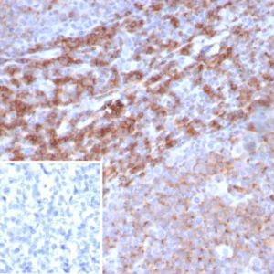 Formalin-fixed, paraffin-embedded human tonsil stained with CD39 Recombinant Rabbit Monoclonal Antibody (CD39/8162R). Inset: PBS instead of primary antibody; secondary only negative control.