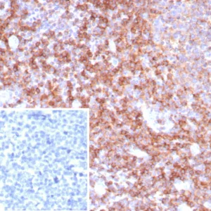 Formalin-fixed, paraffin-embedded human tonsil stained with CD39 Recombinant Rabbit Monoclonal Antibody (CD39/8538R). Inset: PBS instead of primary antibody; secondary only negative control.