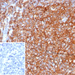 Formalin-fixed, paraffin-embedded human tonsil stained with CD40 Mouse Monoclonal Antibody (CD40/4940). Inset: PBS instead of primary antibody; secondary only negative control.