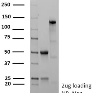 SDS-PAGE Analysis of Purified CD40 Recombinant Rabbit Monoclonal Antibody (C40/9225R). Confirmation of Purity and Integrity of Antibody.