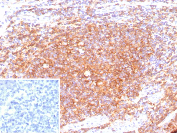 Formalin-fixed, paraffin-embedded human tonsil stained with CD40 Recombinant Rabbit Monoclonal Antibody (C40/9225R). Inset: PBS instead of primary antibody; secondary only negative control.