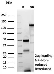 SDS-PAGE Analysis of Purified CD44v6 Recombinant Rabbit Monoclonal (CD44V6/9400R).  Confirmation of Purity and Integrity of Antibody.