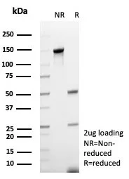 SDS-PAGE Analysis of Purified CD48 Recombinant Mouse Monoclonal Antibody (rCD48/8676). Confirmation of Purity and Integrity of Antibody.