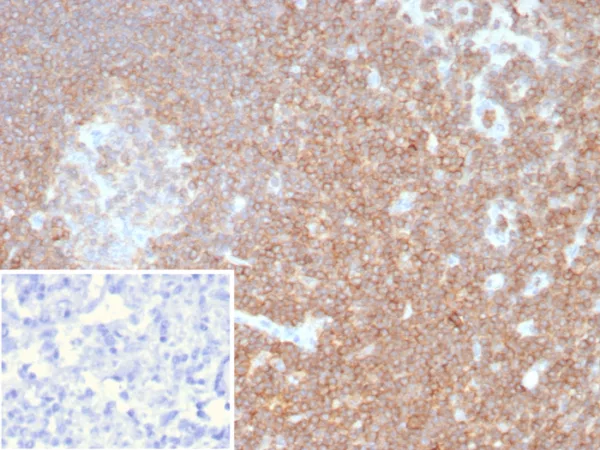 Formalin-fixed, paraffin-embedded human lymph node stained with CD48 Recombinant Mouse Monoclonal Antibody (rCD48/8676). Inset: PBS instead of primary antibody; secondary only negative control.