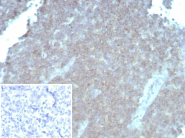 Formalin-fixed, paraffin-embedded human tonsil stained with CD48 Recombinant Mouse Monoclonal Antibody (rCD48/8834). Inset: PBS instead of primary antibody; secondary only negative control.
