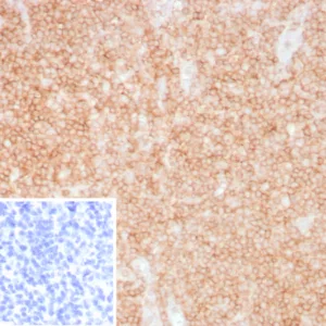 Formalin-fixed, paraffin-embedded human tonsil stained with CD48 Recombinant Rabbit Monoclonal Antibody (CD48/8360R). Inset: PBS instead of primary antibody; secondary only negative control.