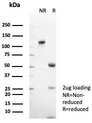 SDS-PAGE Analysis of Purified CD48 Recombinant Rabbit Monoclonal Antibody (CD48/8601R). Confirmation of Purity and Integrity of Antibody.