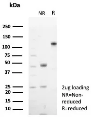 SDS-PAGE Analysis of Purified CD48 Recombinant Rabbit Monoclonal Antibody (CD48/8602R). Confirmation of Purity and Integrity of Antibody.