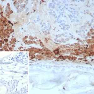 Formalin-fixed, paraffin-embedded human skin stained with Kallikrein 4 Mouse Monoclonal Antibody (KLK4/8941). HIER: Tris/EDTA, pH9.0, 45min. 2°C: HRP-polymer, 30min. DAB, 5min.