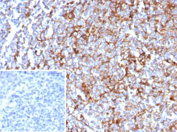 Formalin-fixed, paraffin-embedded human tonsil stained with CD63 Recombinant Mouse Monoclonal Antibody (rLAMP3/8604). Inset: PBS instead of primary antibody; secondary only negative control.